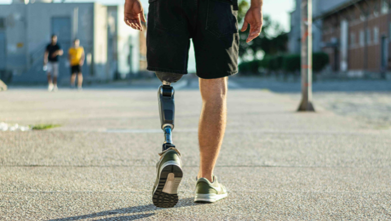 The body of a person from waist down, with a prosthetic leg, walking along the pavement.